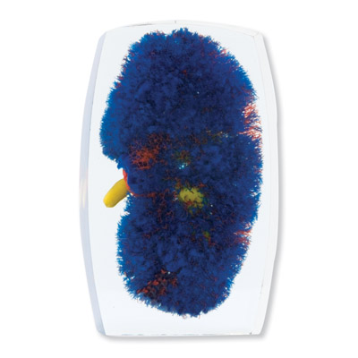 IѪģͣtS{(ln)